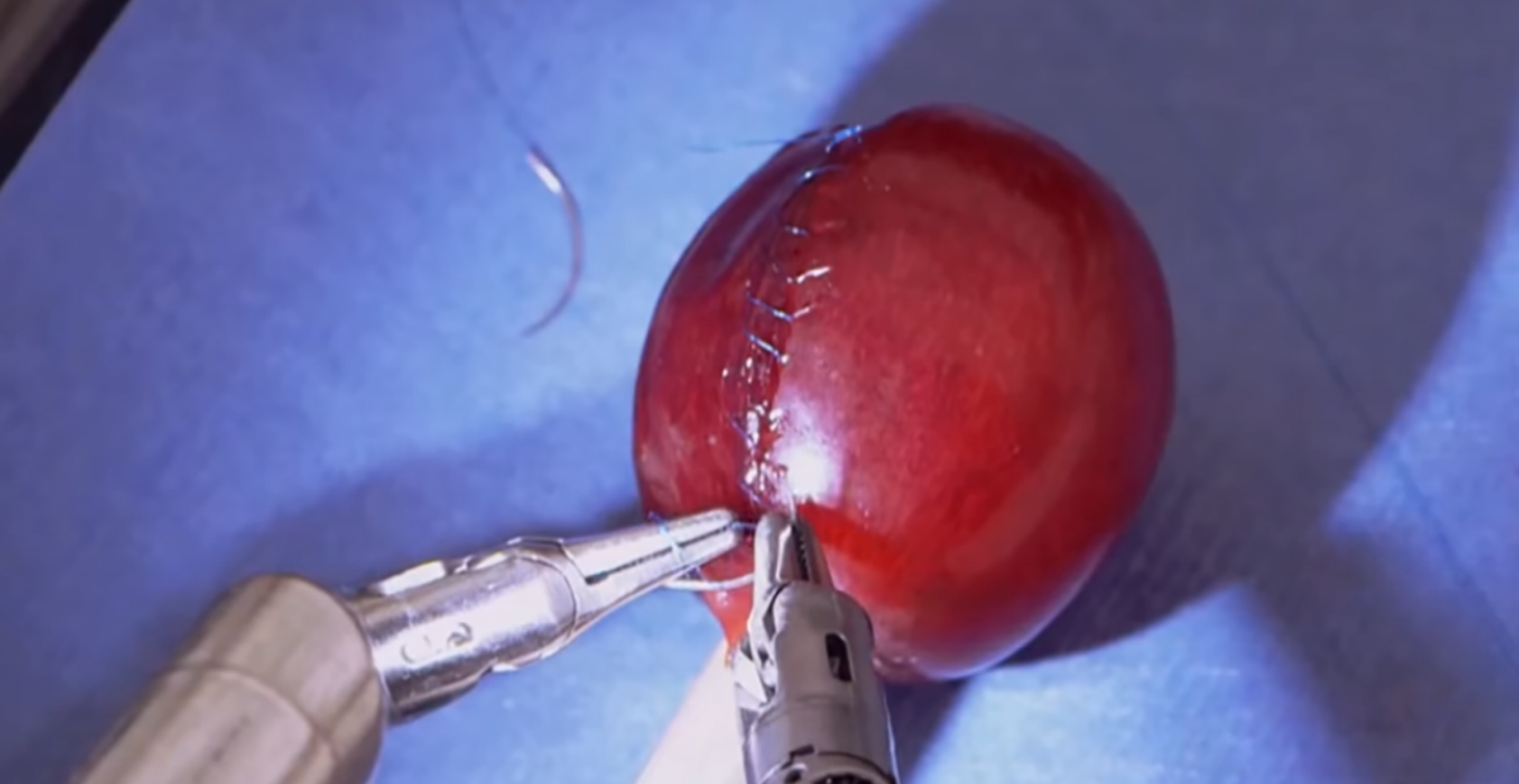“Da Vinci Surgical System“: Dieser Roboter operiert präziser als Chirurgen