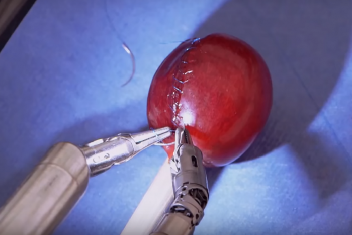 “Da Vinci Surgical System“: Dieser Roboter operiert präziser als Chirurgen