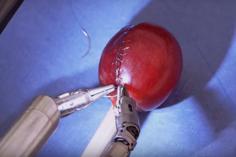 “Da Vinci Surgical System“: Dieser Roboter operiert präziser als Chirurgen