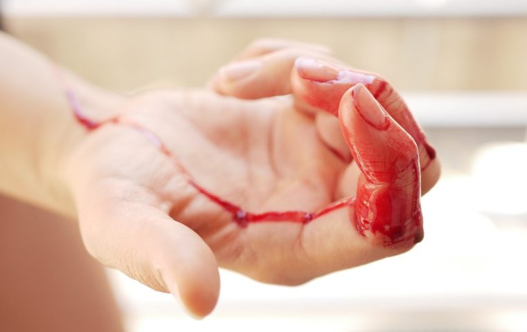 Nie mehr Fake-Blut: Für diese Stockfotos wurde echtes Menstruationsblut verwendet