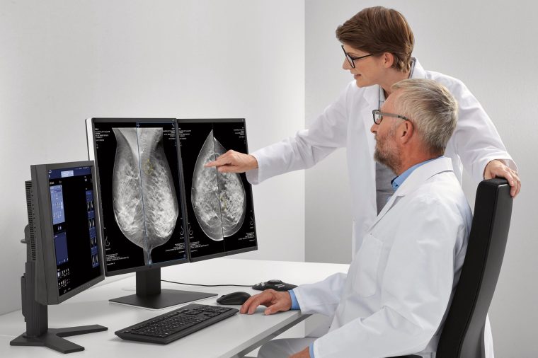 Wie nützlich ist KI in der Diagnostik?