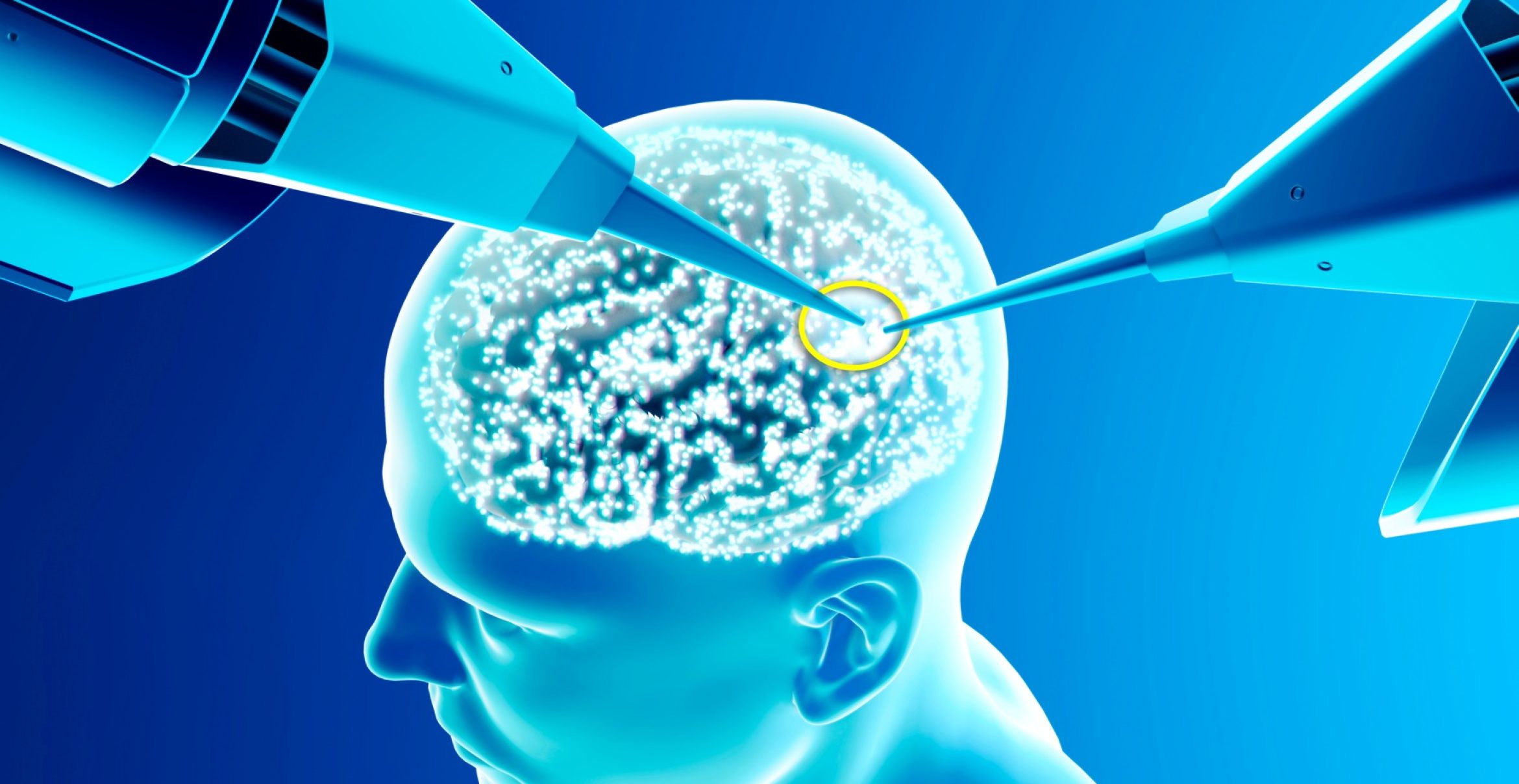 Neurotech-Krieg: China skaliert, Deutschland reguliert
