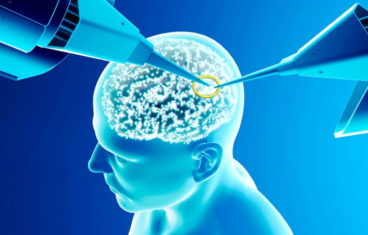 Neurotech-Krieg: China skaliert, Deutschland reguliert