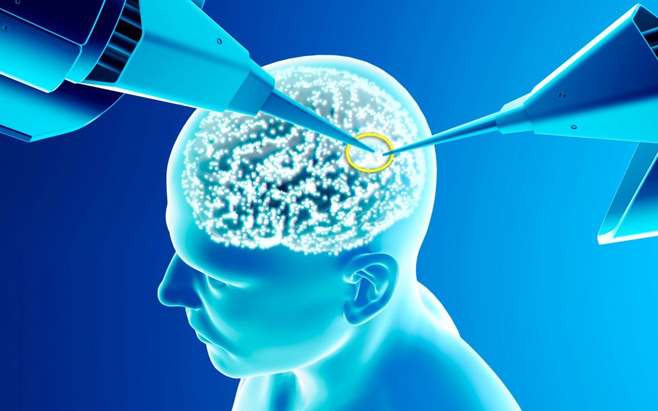 Neurotech-Krieg: China skaliert, Deutschland reguliert