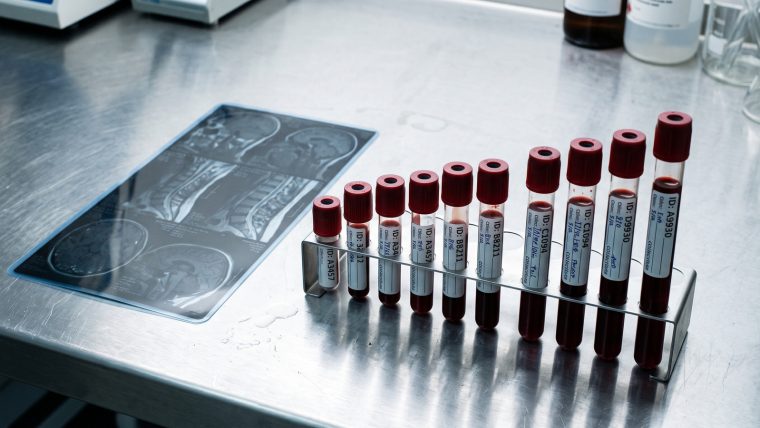 Aeon kauft Aware Health: Vorsorge-Start-up baut Blutdaten-Monopol